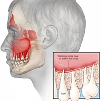 سردرد و دندان درد خطرناک