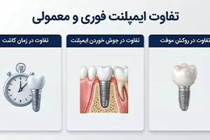 تفاوت ایمپلنت فوری و معمولی