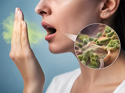 درمان بوی بد دهان