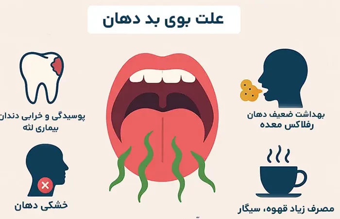 علت بوی بد دهان