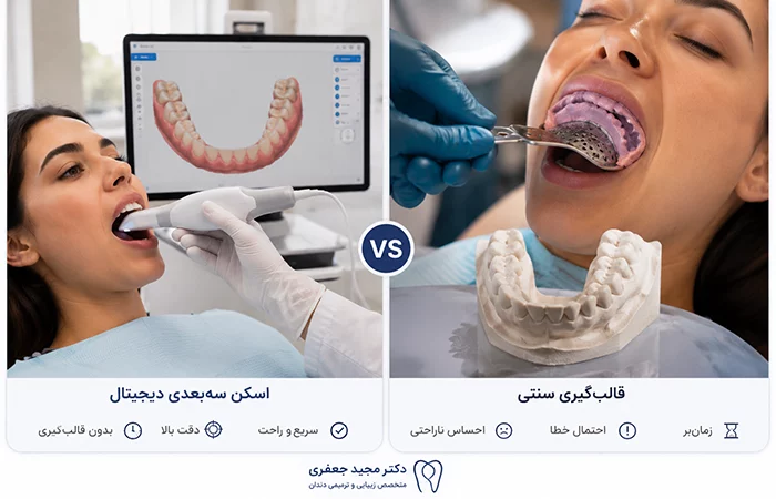 لمینت دیجیتال