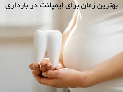 بهترین زمان برای ایمپلنت در بارداری
