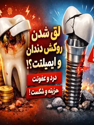 علت لق شدن روکش دندان